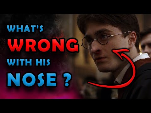What's WRONG with Harry Potter's nose ?