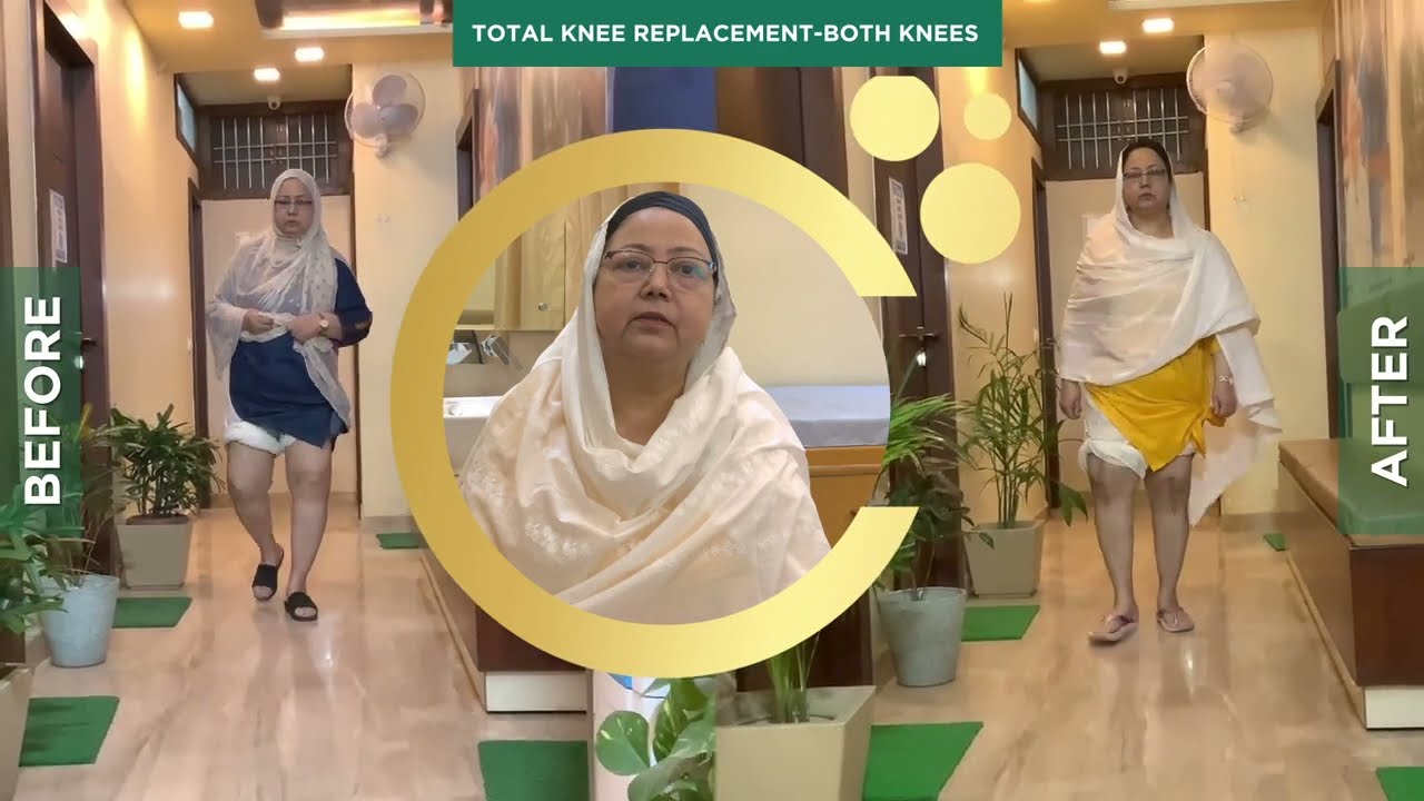 video of knee replacement surgery in Delhi performed by Dr DK Das