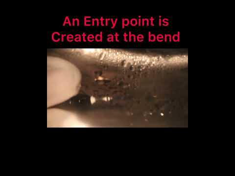 Modified Tube Technique For Broken instrument Retrieval