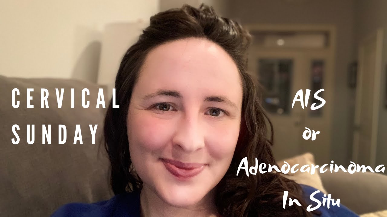 Cervical Sunday and AIS or Adenocarcinoma In Situ