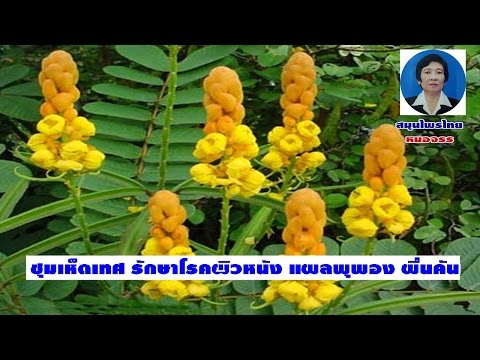 โรคสะเก็ดเงินครีมรักษากลาก การรักษาด่างทับทิมของโรคสะเก็ดเงิน