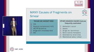 Download lagu What is Thrombotic Microangiopathy (TMA) and Why Should I Care? mp3