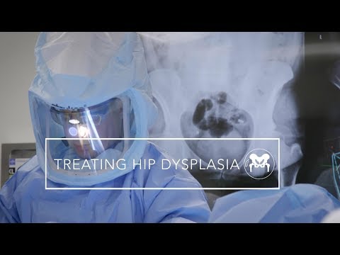 Treating Hip Dysplasia in Young Adults