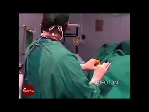 Treatment of Hernia of the Spine by Dr. Gian Paolo Tassi in Italy