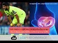 Luis Suarez's right knee meniscus surgery: How it impacts his Copa America and long term health