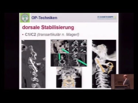 Wie Omega-3 beeinflussen Gelenke Zieht im unteren Rückenbereich der Magenschmerzen gibt