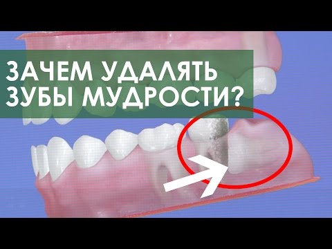 Составляющих коленный сустав Как снять отечность сустава