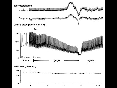 Neurokardiogene Synkope