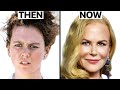 Nicole Kidman's NEW FACE | Plastic Surgery Analysis