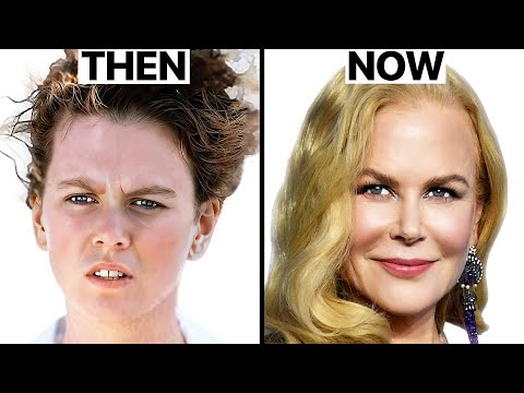 Nicole Kidman's NEW FACE | Plastic Surgery Analysis