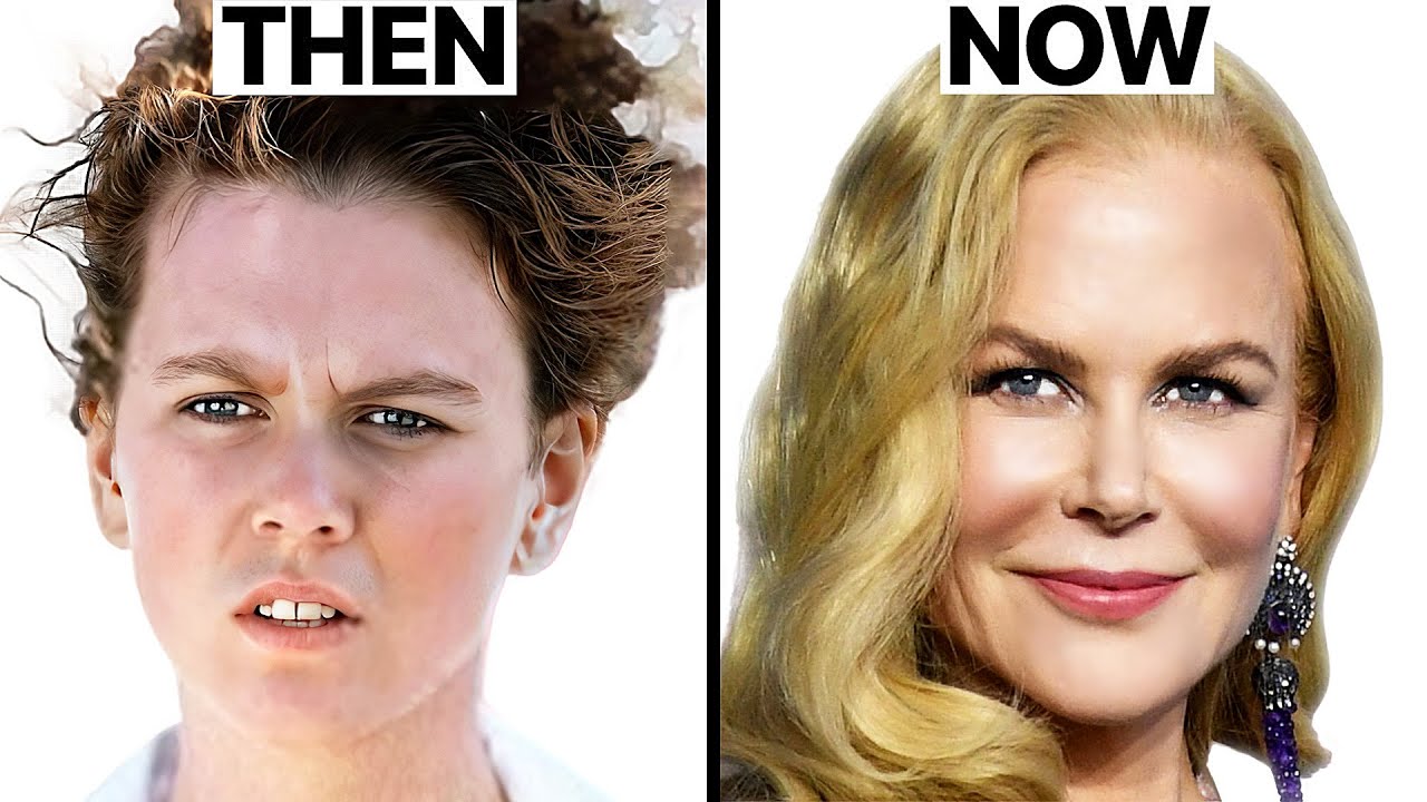 Nicole Kidman's NEW FACE | Plastic Surgery Analysis