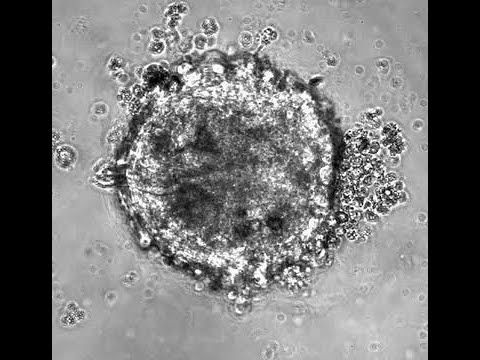 140515 Cardiomyocyte_Repro2_TL