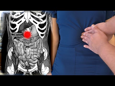 OMT: Visceral - Abdominal Collateral Ganglion Release (Celiac, Superior & Inferior Mesenteric)