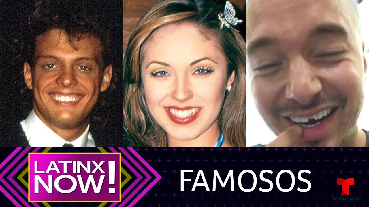 Antes y después de estos famosos que se arreglaron los dientes | Latinx Now! | Entretenimiento