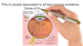 Redness around Iris Causes, Sensitive to Light, on Baby, Ring Eye Socket and Skin