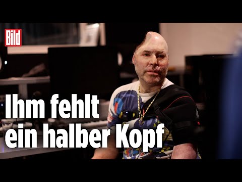 Horror-Unfall: Rapper Dr. Knarf sprengte sich selbst in die Luft