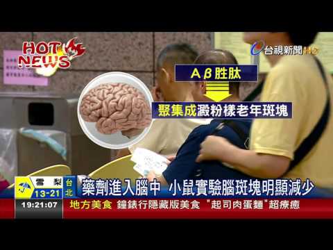 中研院研發新鼻噴劑 可預防阿茲海默症