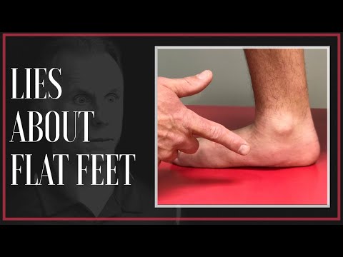 The Big Lie About Flat Feet & Custom Arch Support! (Updated)