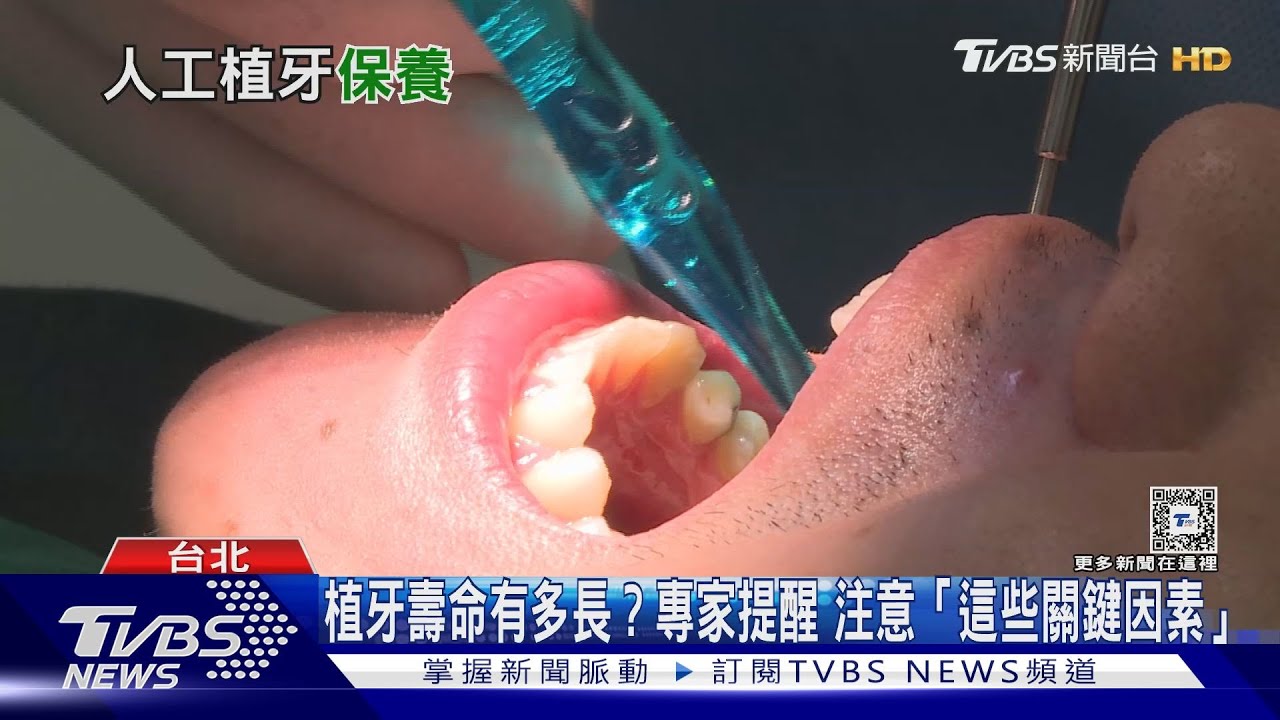 植牙不再是惡夢!專家給攻略:先治療牙周病再進行人工植牙