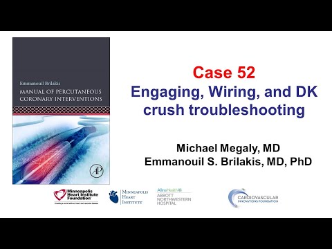 Case 52: PCI Manual - Challenges with engagement, wiring, and DK crush