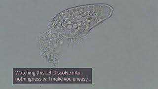 Single-celled Organism Dies