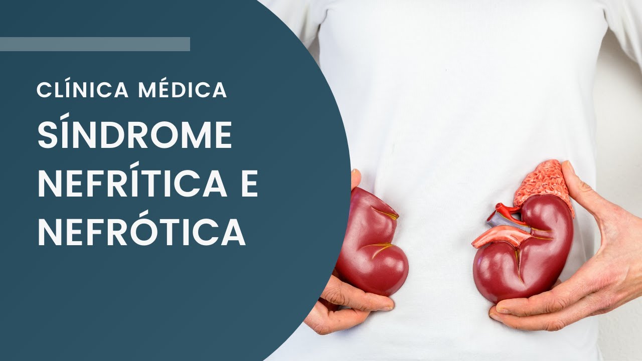 Síndrome Nefrítica e Síndrome Nefrótica