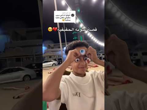 عبادي محمد وقصة عيون صاحبه👀😰#explore #اكسبلور #السعودية #foryou #تحدي #غرائب#تركيا