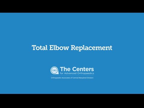 Dr. Khurram Pervaiz Total Elbow Replacement