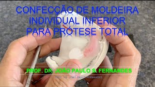 7 Confecção de moldeira individual inferior em Prótese Total