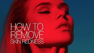 How to quickly remove Skin Redness