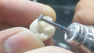 porcelain anatomy #my thursday work