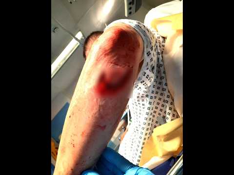 Stabbed. Bitten. Punched. Why Are Police Officers Still Underpaid?