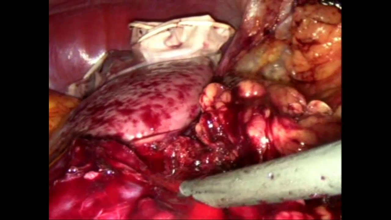 Eduardo Montiel Delgado-23