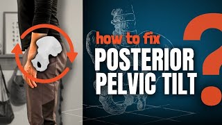 How to Fix Posterior Pelvic Tilt (Complete Guide + Exercises)