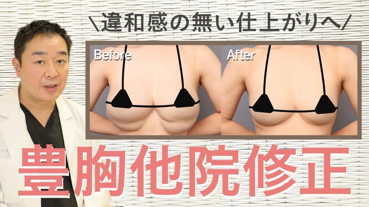 シリコンバッグ豊胸の失敗原因とは?なかなか見れない中身を公開