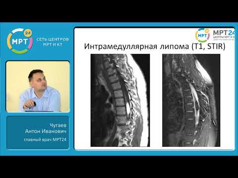 Боль поясницы у девушки Боли в спине под лопатками причины лечение