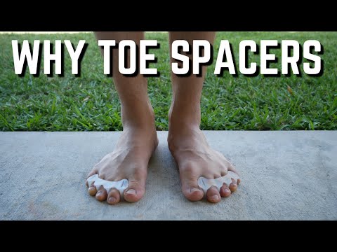 Toe Spacers Are a Simple Way to Prevent Bunions