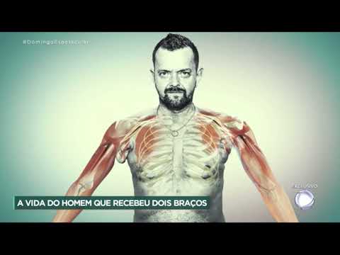 20 months with new arms