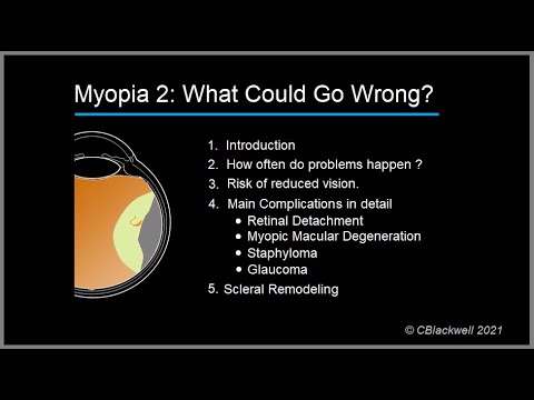 Cum va fi tratată miopia