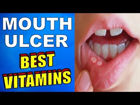 Magpawalang-bisa sa ilalim ng kuko ng daliri ng hinlalaki ng paggamot Lunas para sa mga halamang-singaw paa amoy