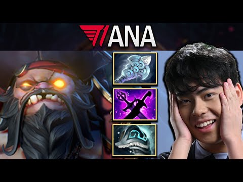 Pudge Dota 2 Gameplay T1.Ana with 30 Kills and Windwalker