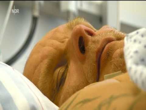 Fernsehbericht vom 4.7.2017, Michael Ackermann, schwere Leberzirrhose