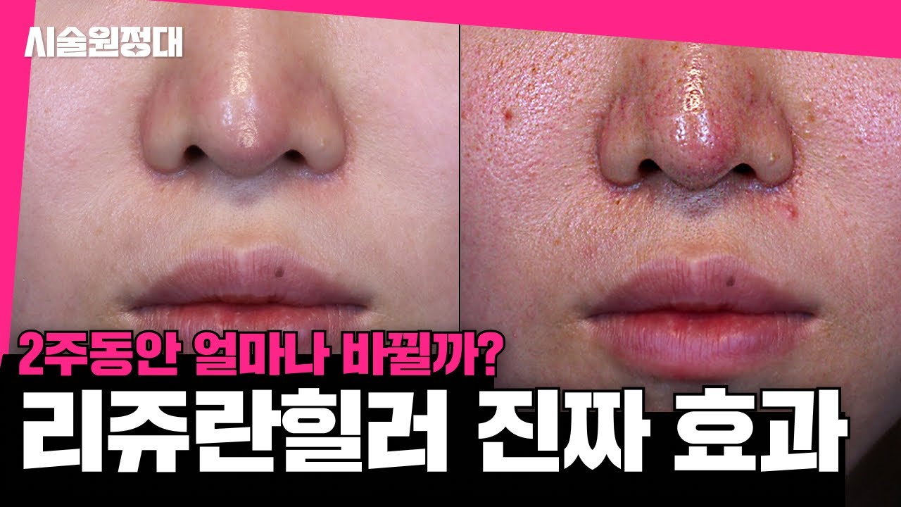 related_video_thumbnail