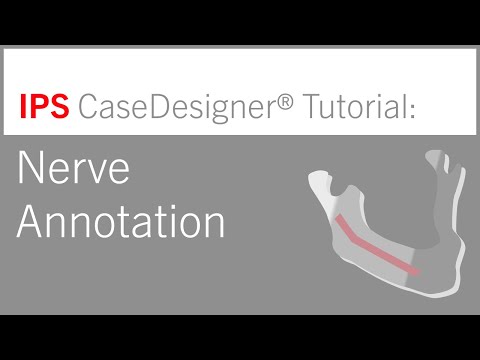 Workflow optional – Nerve Annotation | IPS CaseDesigner® Tutorial