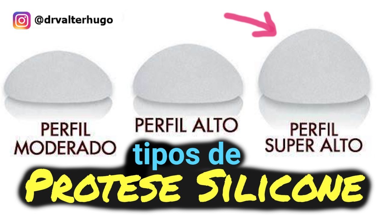 TIPOS PROTESE DE SILICONE : Perfil Super Alto , Moderado , Gota