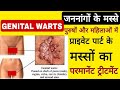 जननांगों के मस्सों का कारण और उपचार Perman