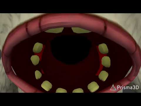 The bite of 87 but msm