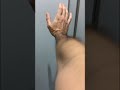肩 カフ筋群の分離 協調運動