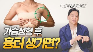 가슴성형 흉터가 생겼다면? 제대로 된 관리로 흉터 없이 예쁜 가슴 유지하는 법!