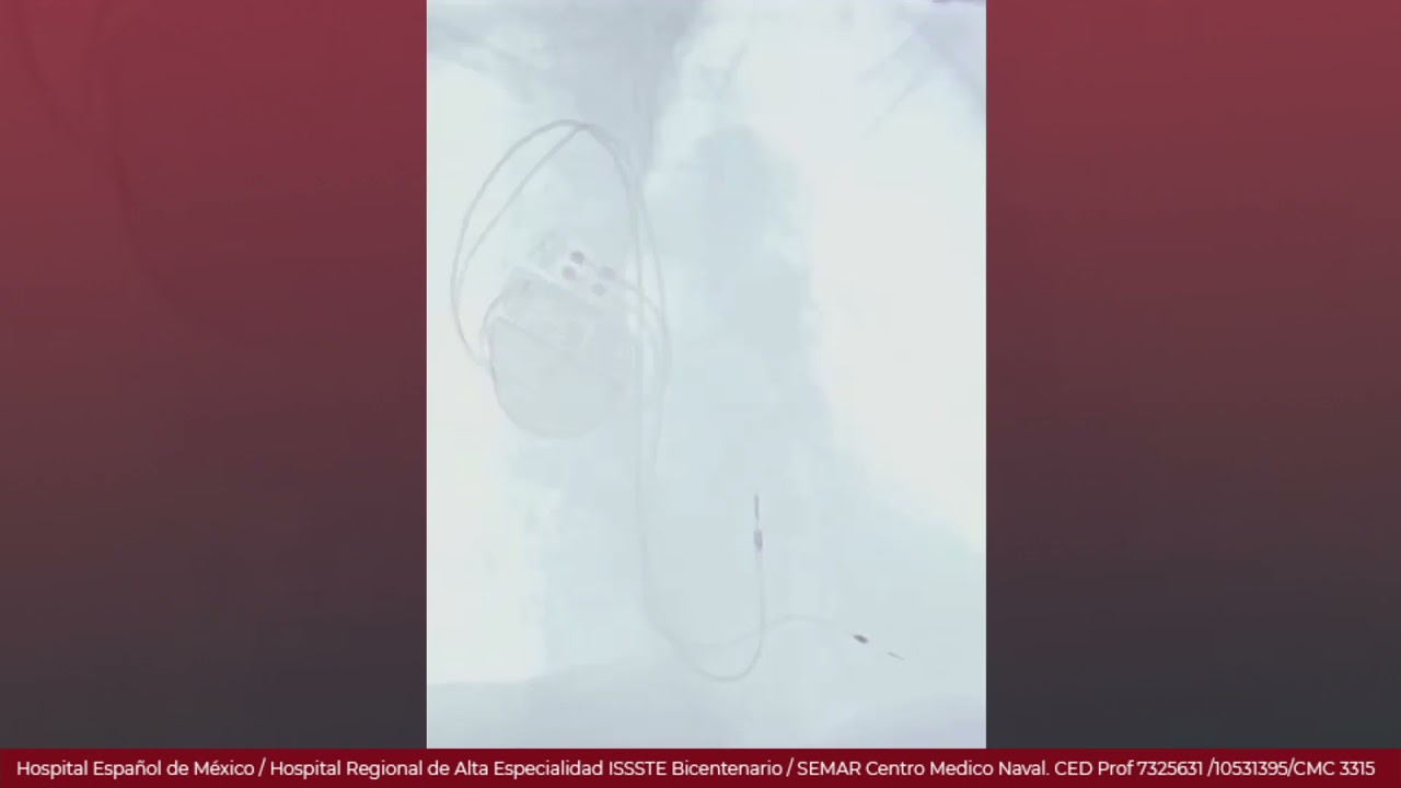 Marcelo Utrera Lagunas-106